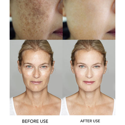 Whitening Facial Serum with Hyaluronic Acid & Vitamin B3