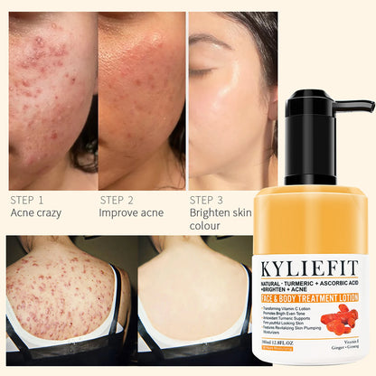 Natural Turmeric Whitening Lotion