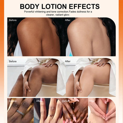 Whitening & Moisturizing Body Lotion