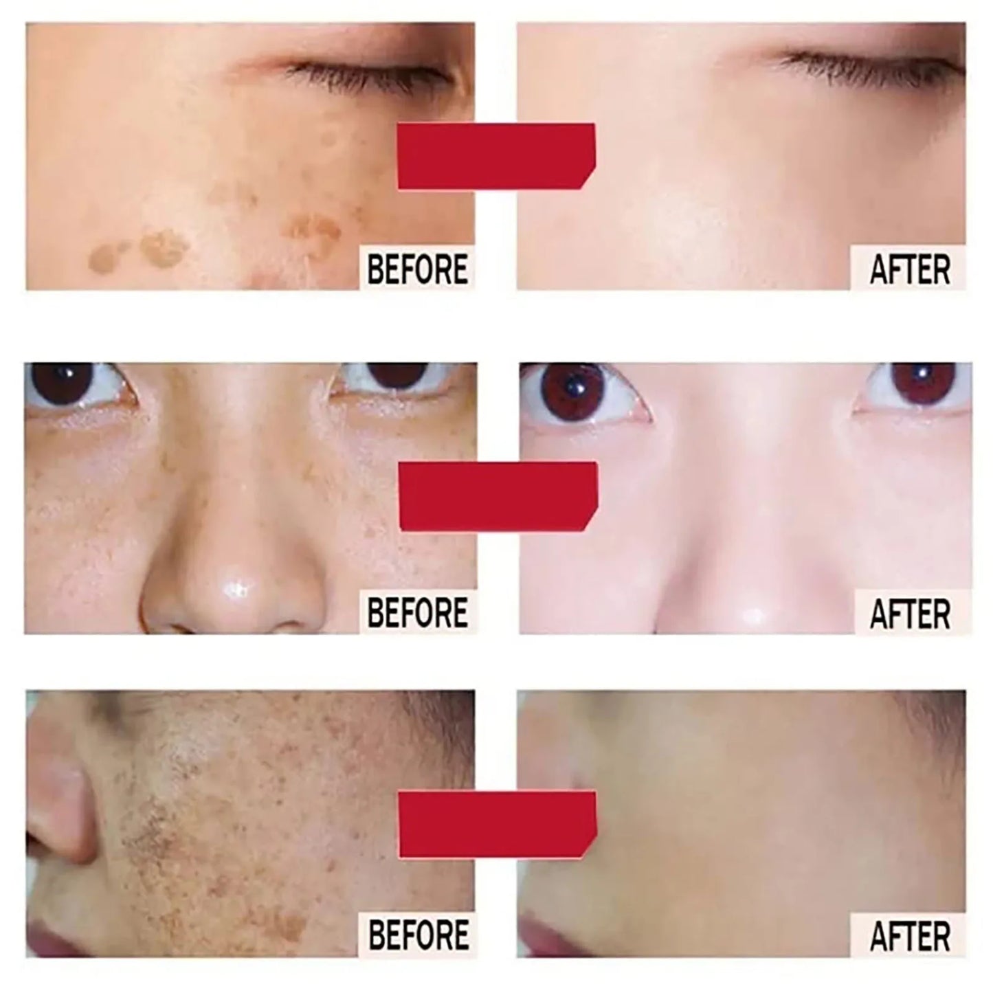 Whitening Face Serum with Kojic Acid