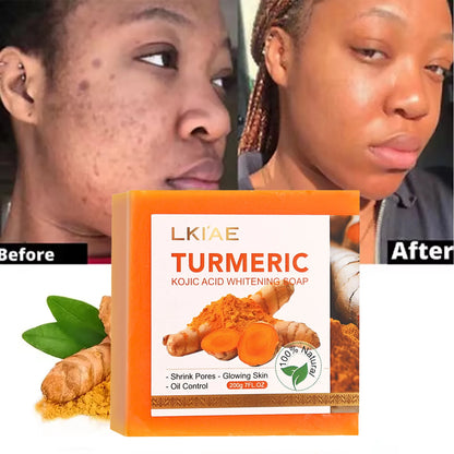 Natural Turmeric Whitening Soap Bar
